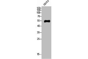 Western Blot analysis of SKOV3 cells using Glut4 Polyclonal Antibody (GLUT4 抗体  (N-Term))