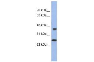 MTRF1L antibody used at 1 ug/ml to detect target protein. (MTRF1L 抗体  (N-Term))