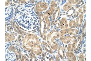 C19ORF28 antibody was used for immunohistochemistry at a concentration of 4-8 ug/ml to stain Epithelial cells of renal tubule (arrows) in Human Kidney.