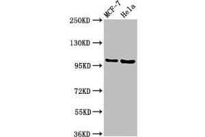 Western Blot Positive WB detected in: MCF-7 whole cell lysate, Hela whole cell lysate All lanes: NUP98 antibody at 3. (NUP98 抗体  (AA 965-1110))