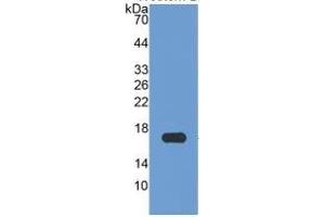 WB of Protein Standard: different control antibodies against Highly purified E. (APOA1 ELISA 试剂盒)