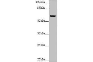 Western blot All lanes: KRT6B antibody at 5. (Keratin 6B 抗体  (AA 1-280))