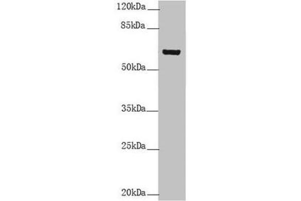 Keratin 6B Antikörper  (AA 1-280)