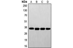 Western blot analysis of FR alpha expression in A431 (A), HeLa (B), HepG2 (C), JAR (D) whole cell lysates. (FOLR1 抗体  (Center))
