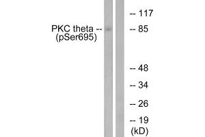 Western blot analysis of extracts from Jurkat cells, treated with EGF (200ng/ml, 15mins), using PKC theta (Phospho-Ser695) antibody. (PKC theta 抗体  (pSer695))