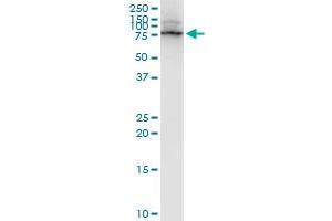 LIMK1 monoclonal antibody (M01), clone 1A8. (LIM Domain Kinase 1 抗体  (AA 548-647))