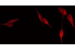 ABIN6276659 staining NIH-3T3 cells by IF/ICC. (CD44 抗体  (Internal Region))
