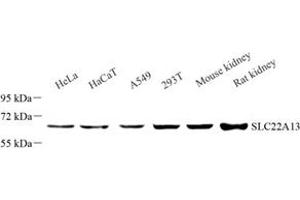 Western blot analysis of SLC22A13 (ABIN7075661) at dilution of 1: 1000 (SLC22A13 抗体)