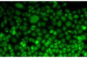 Immunofluorescence analysis of MCF7 cells using UFD1L Polyclonal Antibody (UFD1L 抗体)