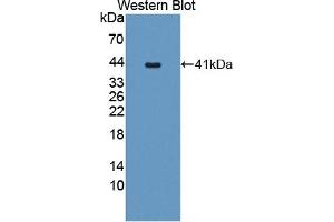 Detection of Recombinant PCSK5, Human using Polyclonal Antibody to Proprotein Convertase Subtilisin/Kexin Type 5 (PCSK5) (PCSK5 抗体  (AA 115-454))