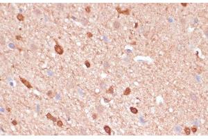 Immunohistochemistry (Paraffin-embedded Sections) (IHC (p)) image for anti-Acetyl-CoA Acetyltransferase 2 (ACAT2) antibody (ABIN7263895)