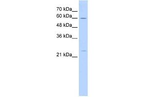 GINS1 antibody used at 5 ug/ml to detect target protein. (GINS1 抗体)