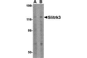 Western Blotting (WB) image for anti-SLIT and NTRK-Like Family, Member 3 (SLITRK3) (C-Term) antibody (ABIN1030683) (SLITRK3 抗体  (C-Term))