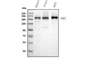 Western blot analysis of UBR2 using anti-UBR2 antibody (ABIN7599610).
