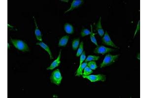 Immunofluorescence staining of Hela cells with ABIN7145343 at 1:133, counter-stained with DAPI. (Beclin 1 抗体  (AA 1-100))