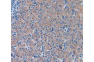 Used in DAB staining on fromalin fixed paraffin- embedded Kidney tissue (LCN5 抗体  (AA 28-187))