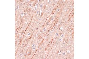 Immunohistochemistry of paraffin-embedded rat brain using DLG3 antibody (ABIN7266794) at dilution of 1:100 (40x lens). (DLG3 抗体  (AA 464-817))