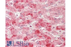 ABIN1590112 (5µg/ml) staining of paraffin embedded Human Liver. (TBK1 抗体  (AA 514-527))