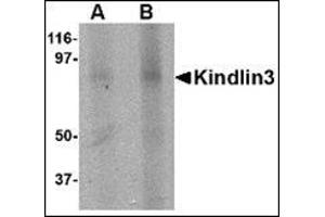 Western blot analysis of KINDLIN3 in rat spleen lysate with this product at (A) 1 and (B) 2 μg/ml. (FERMT3 抗体  (C-Term))