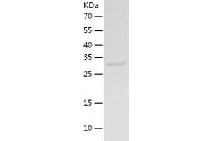 Western Blotting (WB) image for Muscle, Skeletal, Receptor Tyrosine Kinase (MUSK) (AA 756-869) protein (His-IF2DI Tag) (ABIN7282421) (MUSK Protein (AA 756-869) (His-IF2DI Tag))