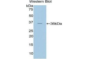Western Blotting (WB) image for anti-Tissue Factor Pathway Inhibitor (Lipoprotein-Associated Coagulation Inhibitor) (TFPI) (AA 29-306) antibody (ABIN1078583) (TFPI 抗体  (AA 29-306))
