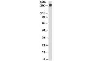 Western Blotting (WB) image for anti-Temporarily Assigned Gene Name Family Member (TAG-72) antibody (ABIN3026071)
