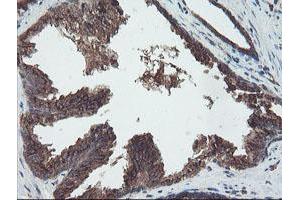 Image no. 13 for anti-Diphthamide Biosynthesis Protein 2 (DPH2) antibody (ABIN1497893)