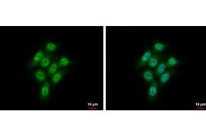 ICC/IF Image CMPK1 antibody [N1C3] detects CMPK1 protein at cytoplasm and nucleus by immunofluorescent analysis. (Cytidine Monophosphate (UMP-CMP) Kinase 1, Cytosolic (CMPK1) (Center) 抗体)