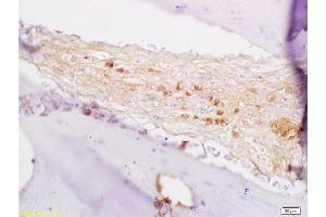 Formalin-fixed and paraffin embedded rabbit alveolar bone labeled with Anti-BMP7 Polyclonal Antibody, Unconjugated  at 1:200 followed by conjugation to the secondary antibody and DAB staining. (BMP7 抗体  (AA 293-350))