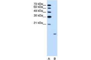 WB Suggested Anti-GCG Antibody Titration:  1. (Glucagon 抗体  (N-Term))