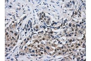 Immunohistochemical staining of paraffin-embedded Kidney tissue using anti-HDAC10mouse monoclonal antibody. (HDAC10 抗体)