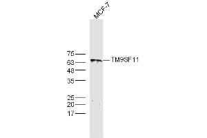MCF-7 lysates probed with TM9SF1 Polyclonal Antibody, Unconjugated  at 1:300 dilution and 4˚C overnight incubation. (TM9SF1 抗体  (AA 51-150))