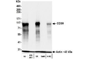 Western Blotting (WB) image for anti-Tumor Necrosis Factor Receptor Superfamily, Member 8 (TNFRSF8) (AA 19-385) antibody (ABIN7454029)