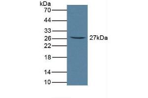 Detection of FcaR in Rat Serum using Polyclonal Antibody to Fc Fragment Of IgA Receptor (FcaR) (FCAR 抗体  (AA 51-280))