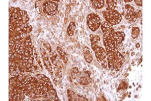 IHC-P Image Immunohistochemical analysis of paraffin-embedded SW480 xenograft, using CaMKIV, antibody at 1:500 dilution. (CAMK4 抗体)