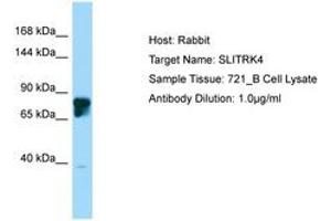 Image no. 1 for anti-SLIT and NTRK-Like Family, Member 4 (SLITRK4) (AA 661-710) antibody (ABIN6750228) (SLITRK4 抗体  (AA 661-710))