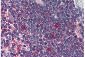 Immunohistochemistry (Formalin-fixed Paraffin-embedded Sections) (IHC (fp)) image for anti-Cyclin-Dependent Kinase 1 (CDK1) antibody (ABIN462412)