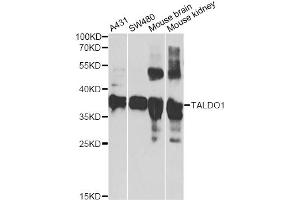 Western blot analysis of extracts of various cell lines, using TALDO1 antibody (ABIN2560291) at 1:1000 dilution.