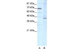 WB Suggested Anti-LHX2 Antibody Titration:  2. (LHX2 抗体  (Middle Region))