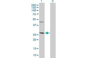 Western Blot analysis of CERK expression in transfected 293T cell line by CERK MaxPab polyclonal antibody. (CERK 抗体  (AA 1-201))
