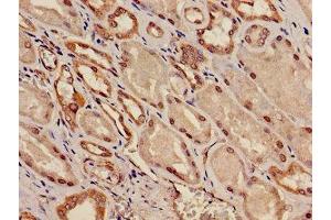 Immunohistochemistry of paraffin-embedded human kidney tissue using ABIN7163916 at dilution of 1:100 (KCNK1 抗体  (AA 268-336))