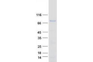 Validation with Western Blot