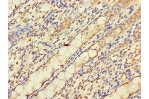 Immunohistochemistry of paraffin-embedded human colon tissue using ABIN7162692 at dilution of 1:100 (PNPLA2 抗体  (AA 1-504))