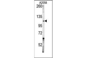 Image no. 1 for anti-C-Abl Oncogene 1, Non-Receptor tyrosine Kinase (ABL1) (Middle Region) antibody (ABIN359968) (ABL1 抗体  (Middle Region))