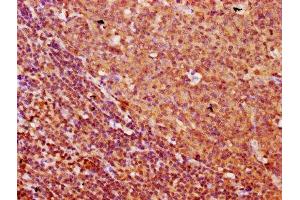 IHC image of ABIN7153151 diluted at 1:500 and staining in paraffin-embedded human tonsil tissue performed on a Leica BondTM system. (FREM1 抗体  (AA 1957-2082))