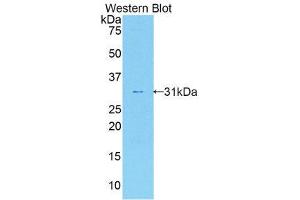 Western Blotting (WB) image for anti-Interleukin 17 Receptor A (IL17RA) (AA 590-848) antibody (ABIN1859358)