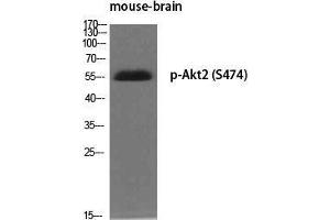 Western Blot (WB) analysis of specific cells using Phospho-Akt2 (S474) Polyclonal Antibody.