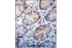 Immunohistochemistry (Paraffin-embedded Sections) (IHC (p)) image for anti-Complement Component 1, Q Subcomponent, C Chain (C1QC) (AA 93-120) antibody (ABIN655873)