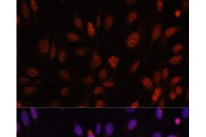 Immunofluorescence analysis of U-2 OS cells using HOXB1 Polyclonal Antibody at dilution of 1:100. (HOXB1 抗体)