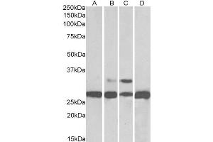 ABIN184567 (0. (PGAM1/2/4 抗体  (C-Term))